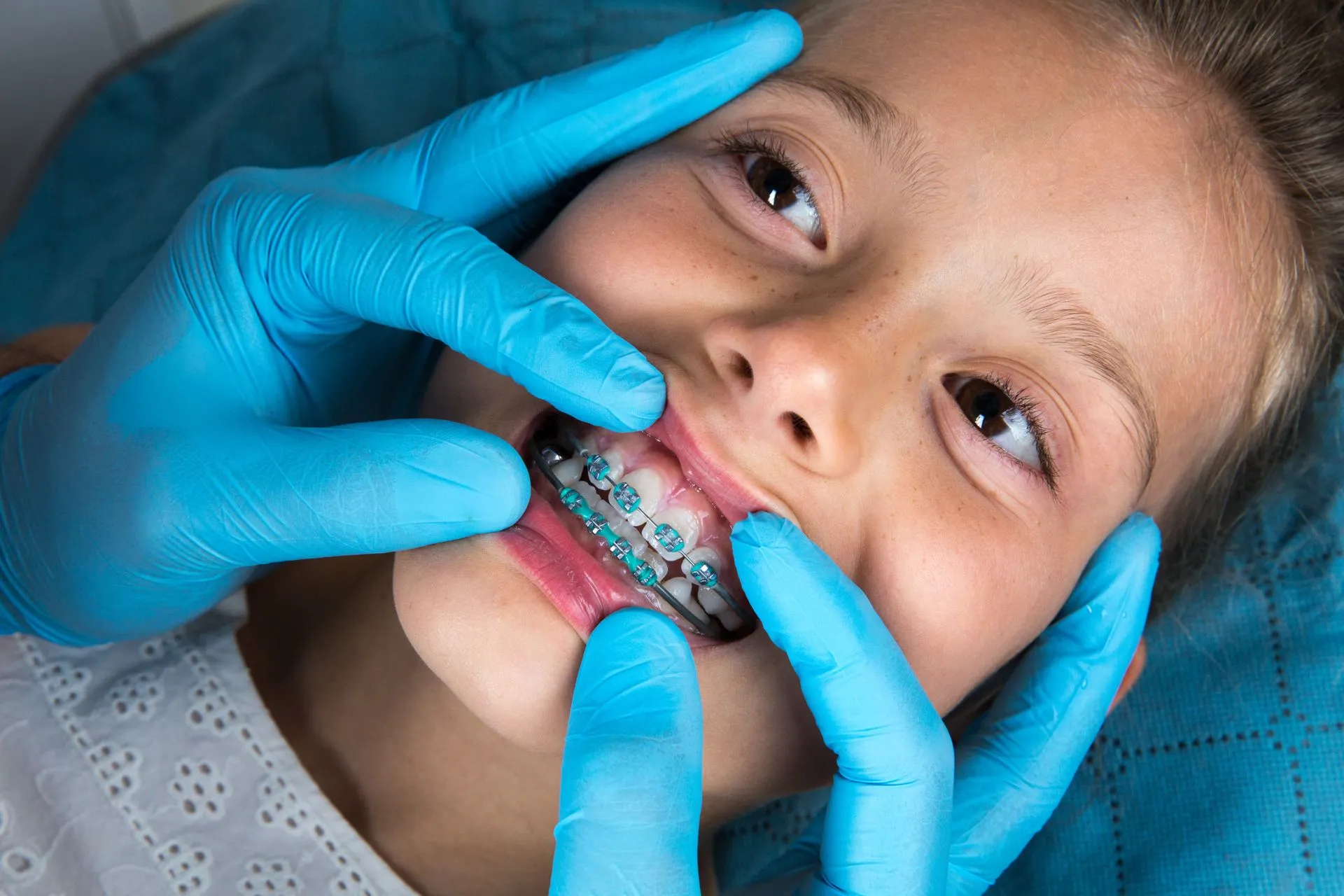 Braces in Colleyville Texas | Cost & Care Guide – Dr. Peikar